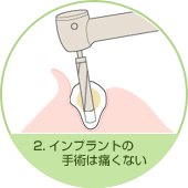 2.�C���v�����g��p�͒ɂ��Ȃ����S